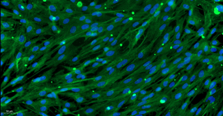 Primary Rat Meningeal Cells (MC)