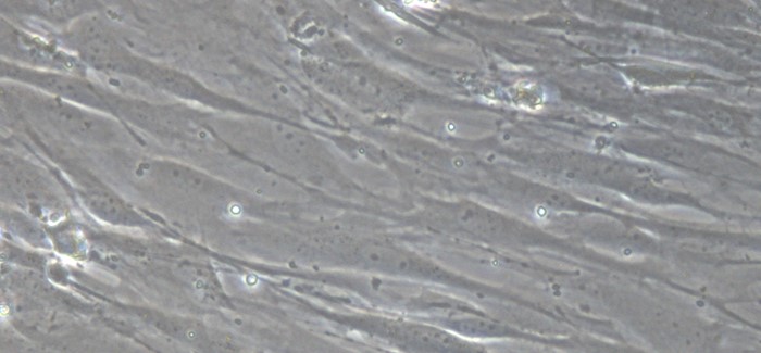 Primary Mouse Conjunctival Fibroblasts (CJVF)