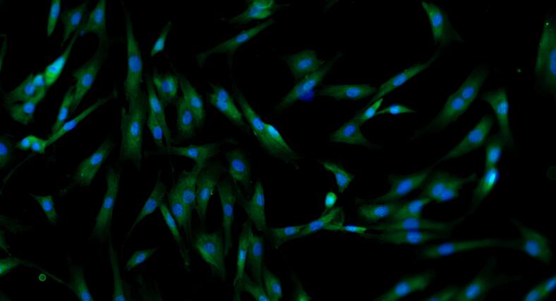 Primary Rat Trabecular Meshwork Cells (TMC)