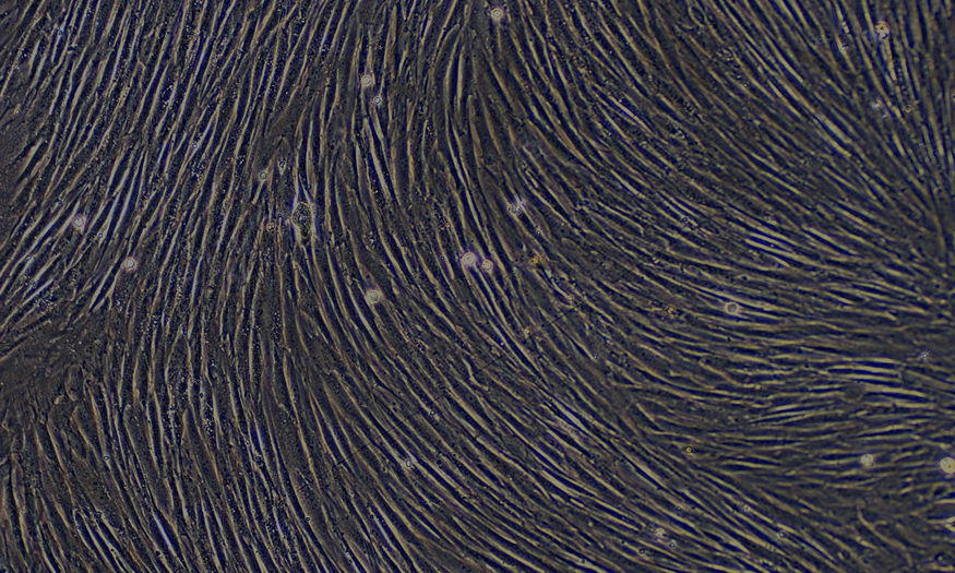 Primary Rabbit Skeletal Muscle Cells (SkMC)