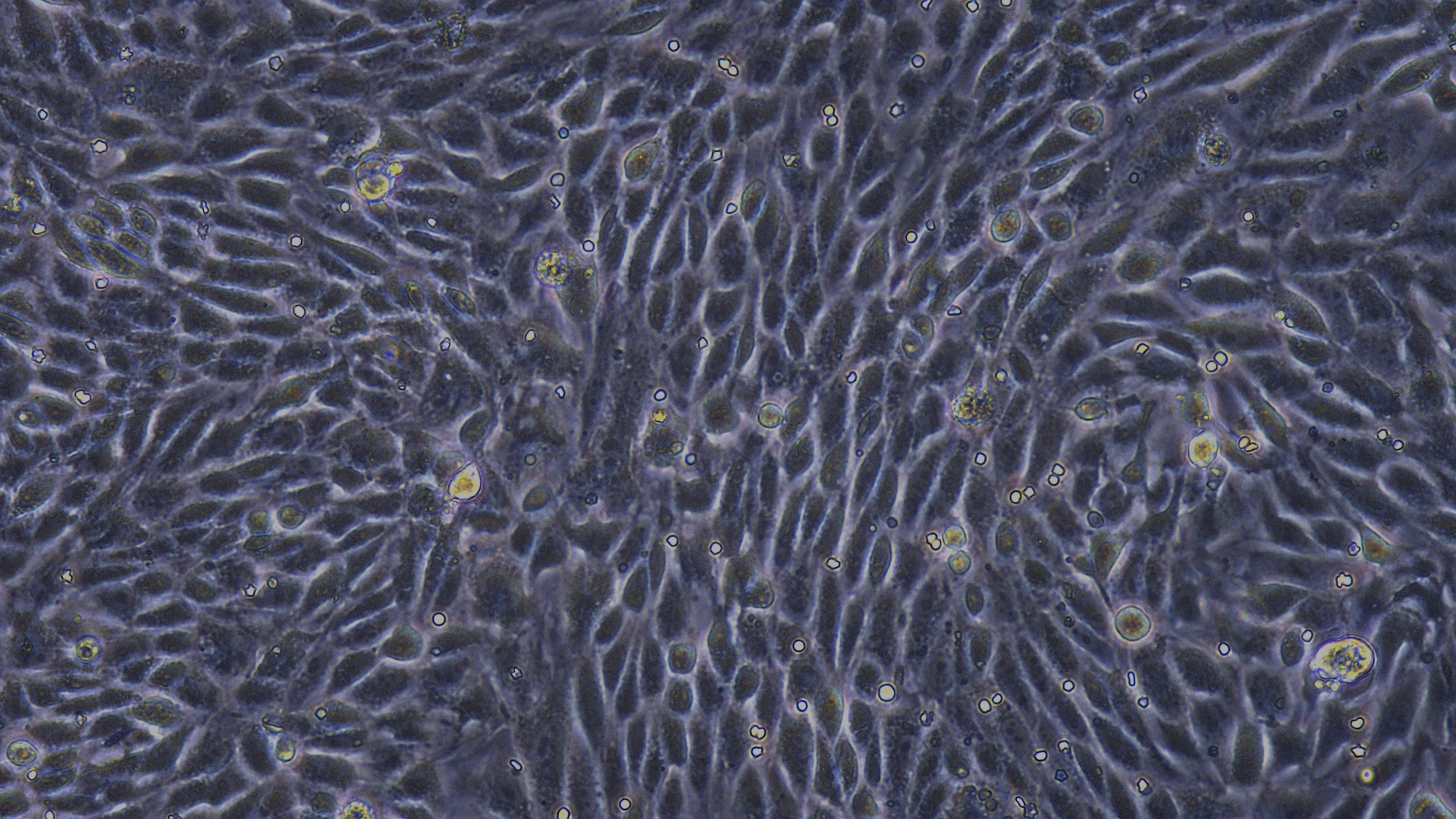 Primary Mouse Renal  Tubular Epithelial Cells (RTEC)