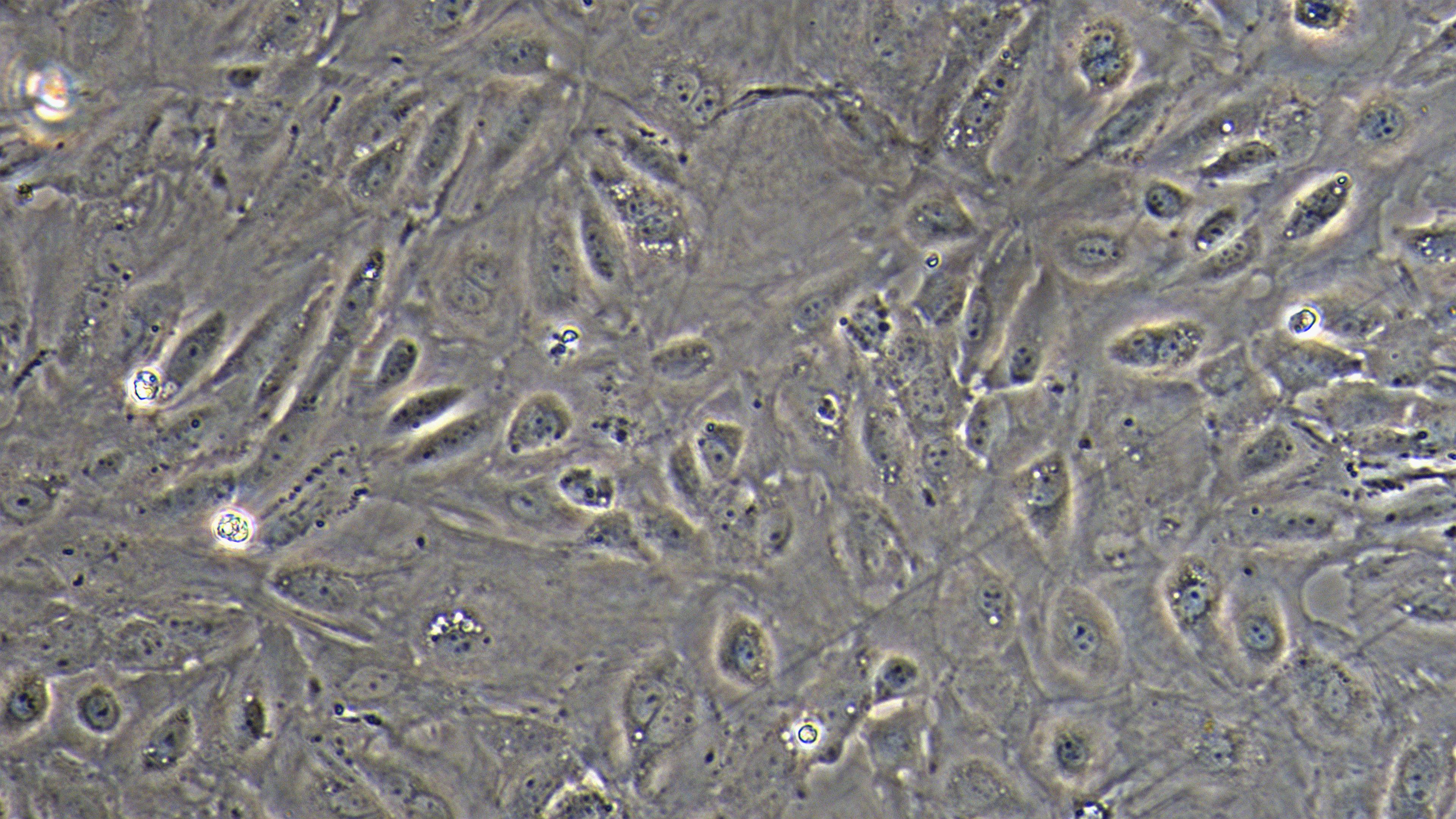 Primary Rat Renal  Tubular Epithelial Cells (RTEC)