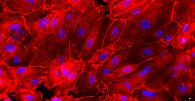 Primary Canine Urethral Epithelial Cells (UrEC)