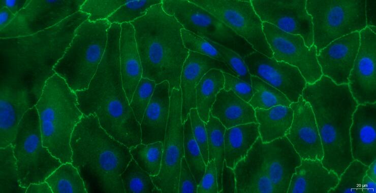 Primary Caprine Urethral Epithelial Cells (UrEC)