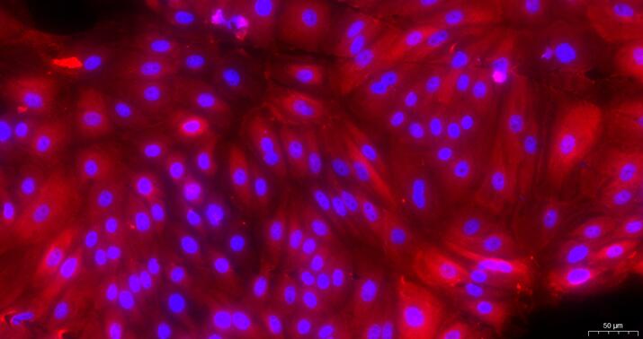 Primary Caprine Urethral Epithelial Cells (UrEC)