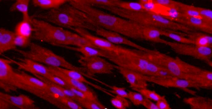 Primary Canine Bladder Smooth Muscle Cells (BSMC)