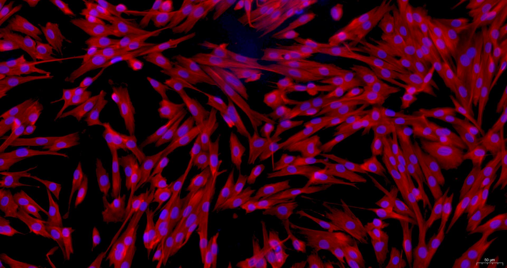 Primary Canine Bladder Stromal Fibroblasts (BSF)