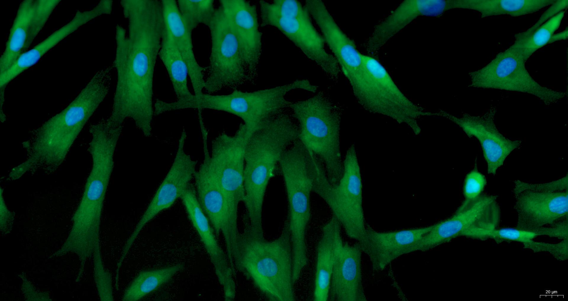 Primary Canine Bladder Stromal Fibroblasts (BSF)