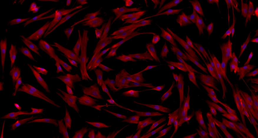 Primary Mouse Bladder Stromal Fibroblasts (BSF)