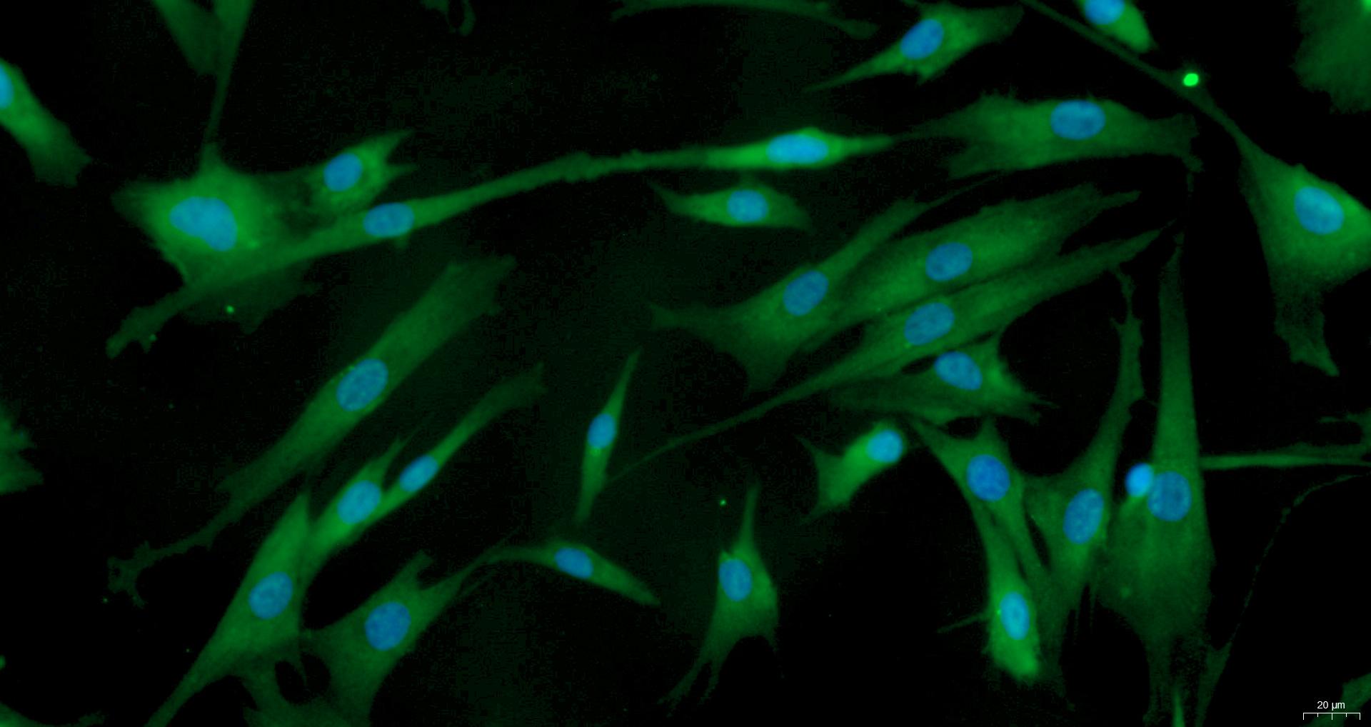 Primary Rabbit Bladder Stromal Fibroblasts (BSF)