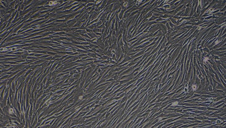 Primary Rabbit Bladder Stromal Fibroblasts (BSF)