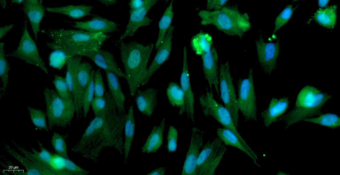 Primary Canine Tracheal Smooth Muscle Cells (TSMC)