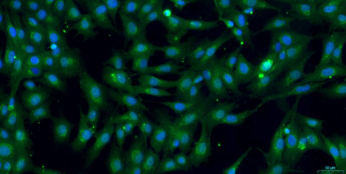 Primary Caprine Tracheal Smooth Muscle Cells (TSMC)