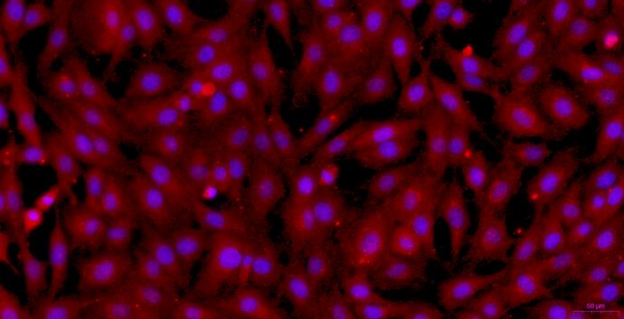 Primary Caprine Tracheal Smooth Muscle Cells (TSMC)