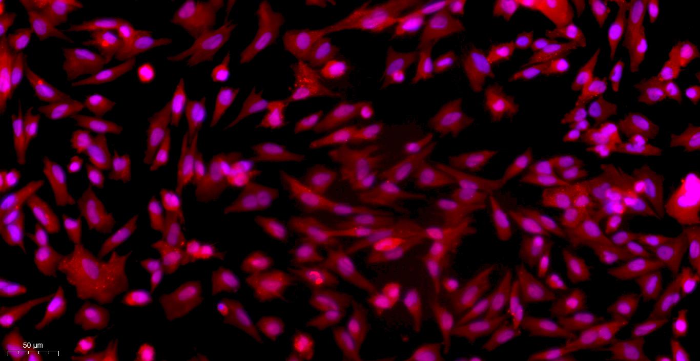 Primary Rat Tracheal Smooth Muscle Cells (TSMC)