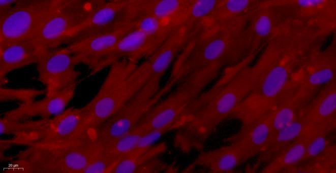 Primary Rabbit Tracheal Smooth Muscle Cells (TSMC)