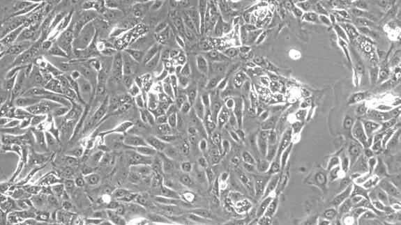 Primary Canine Tracheal Epithelial Cells (TEC)