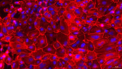 Primary Mouse Tracheal Epithelial Cells (TEC)