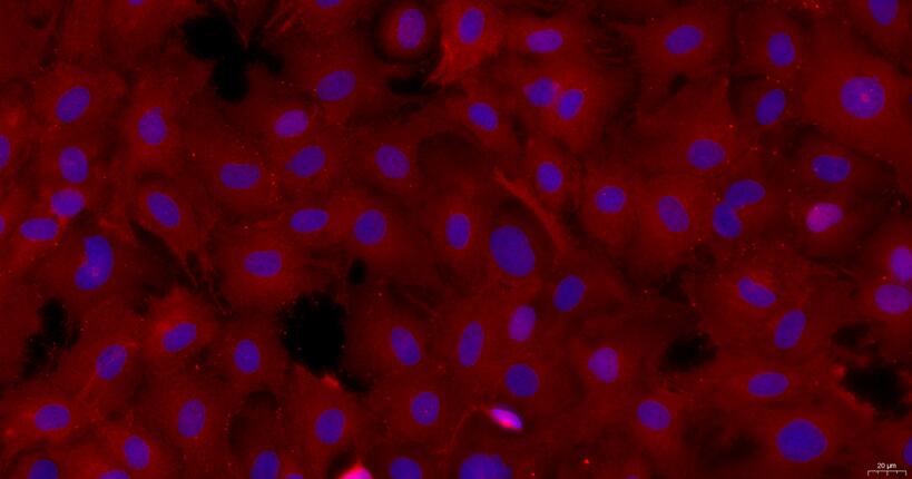 Primary Rat Tracheal Epithelial Cells (TEC)