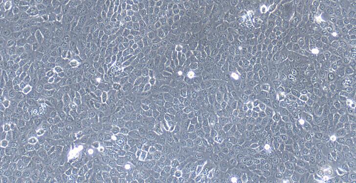 Primary Mouse Neonatal Epidermal Keratinocytes (NEK)