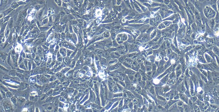 Primary Rabbit Neonatal Epidermal Keratinocytes (NEK)