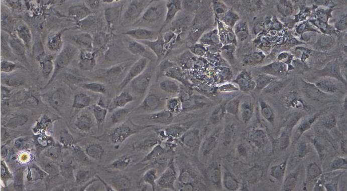 Primary Mouse Dermal Microvascular Endothelial Cells (DMEC)