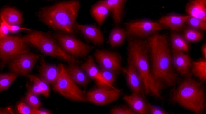 Primary Mouse Dermal Microvascular Endothelial Cells (DMEC)