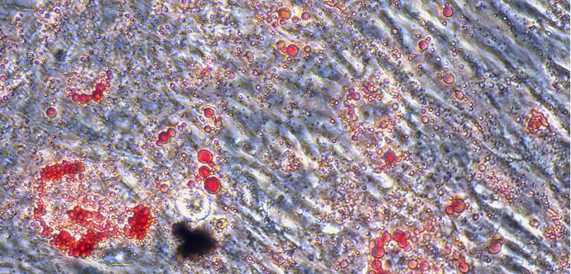 Primary Mouse Visceral Preadipocytes (VPA)