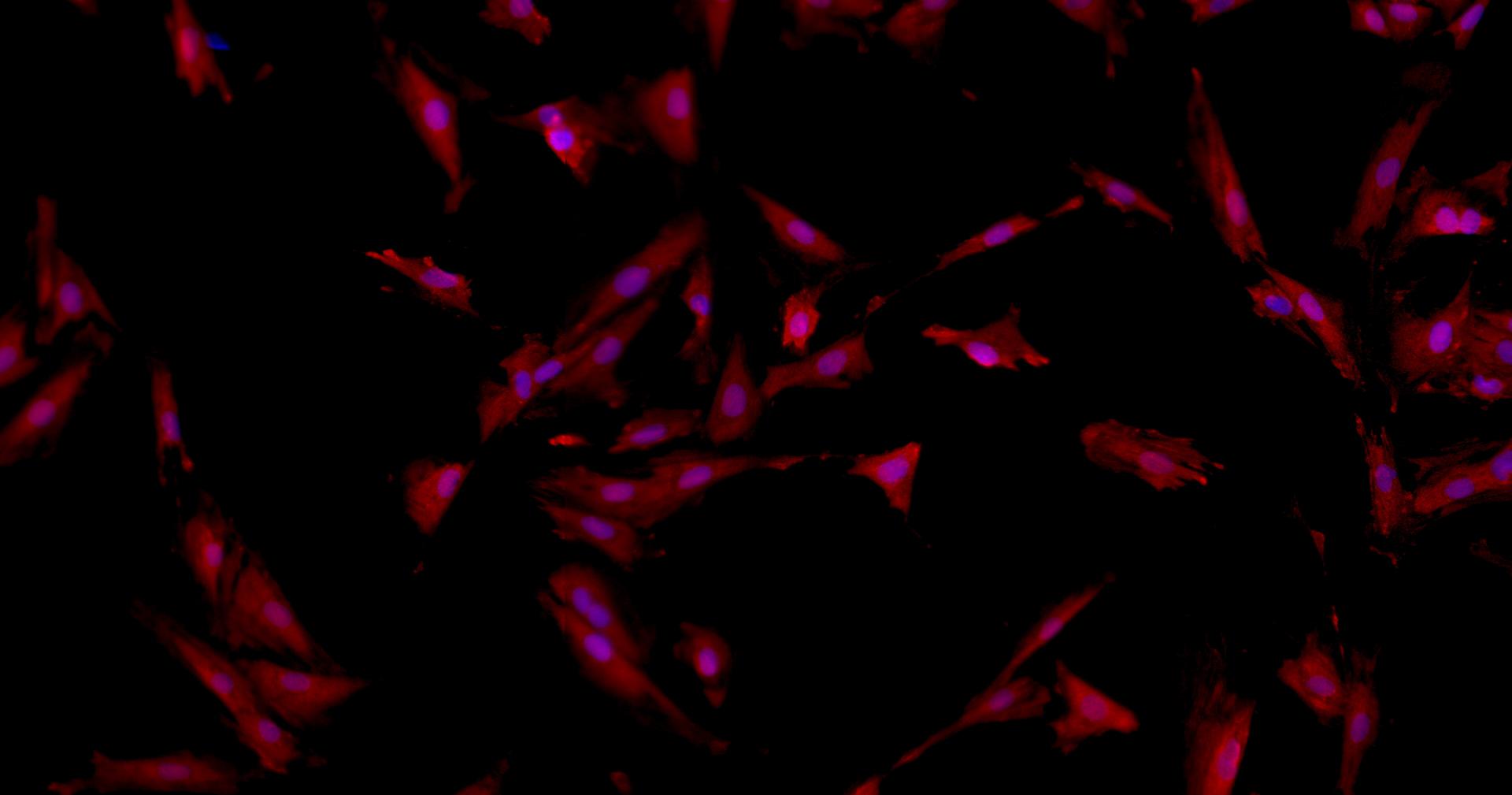 Primary Mouse Neonatal Dermal Fibroblasts (NDF)