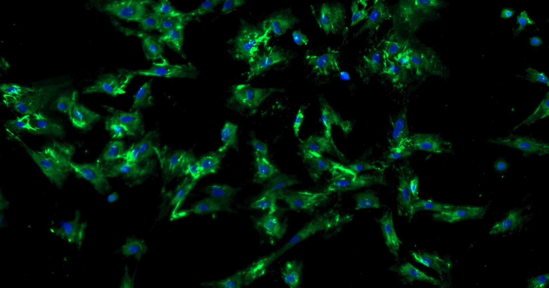 Primary Mouse Neonatal Dermal Fibroblasts (NDF)