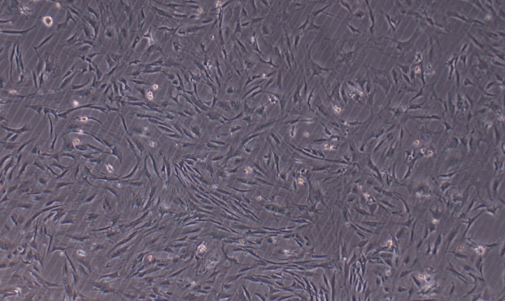 Primary Rat Adrenal Fibroblasts (ADF)