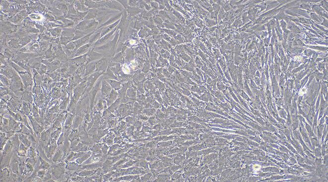 Primary Rat Cardiac Fibroblasts (CF)