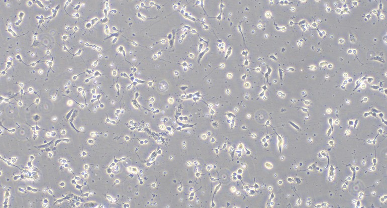 Primary Mouse Hippocampal Neuron Cells  (HNC)