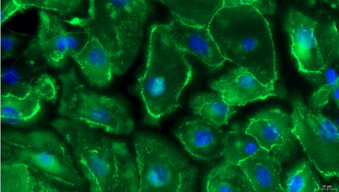 Primary Mouse Esophageal Epithelial Cells (EEC)