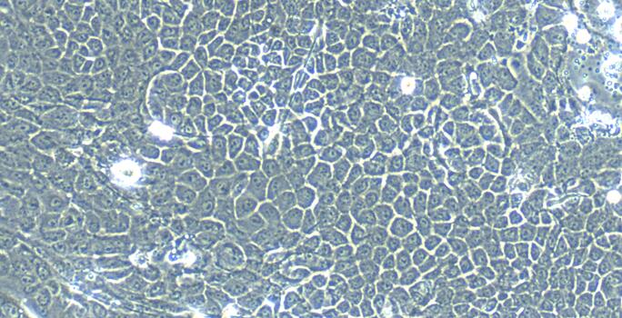 Primary Mouse Esophageal Epithelial Cells (EEC)