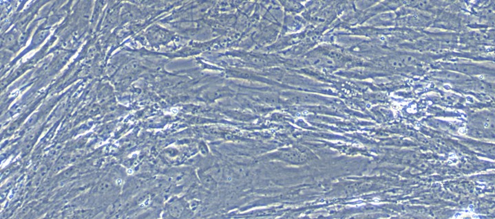 Primary Mouse Colonic Smooth Muscle Cells (CSMC)