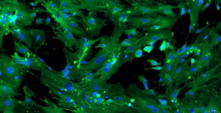 Primary Mouse Colonic Smooth Muscle Cells (CSMC)