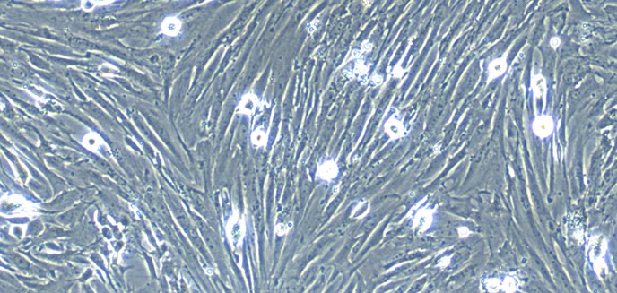 Primary Rat Colonic Smooth Muscle Cells (CSMC)