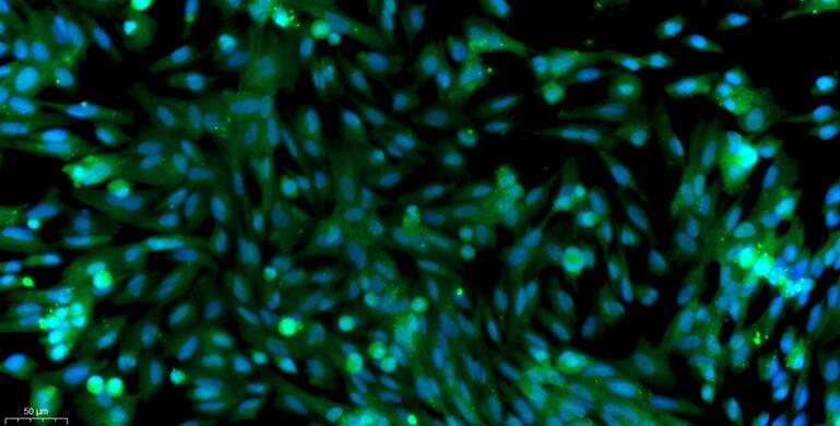 Primary Canine Esophageal Smooth Muscle Cells (ESMC)