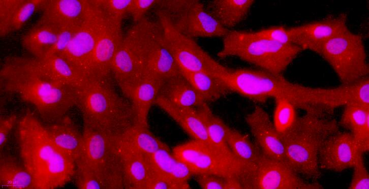 Primary Caprine Esophageal Smooth Muscle Cells (ESMC)