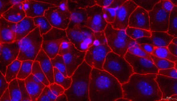 Primary Rat Cervical Epithelial Cells (CrEC)