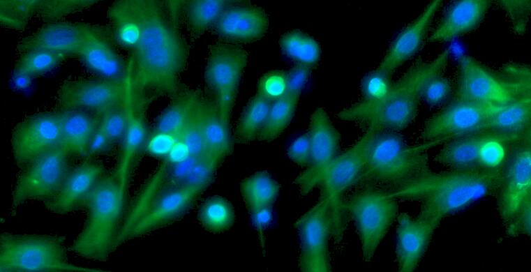 Primary Mouse Adipose Microvascular Endothelial Cells (AMEC)