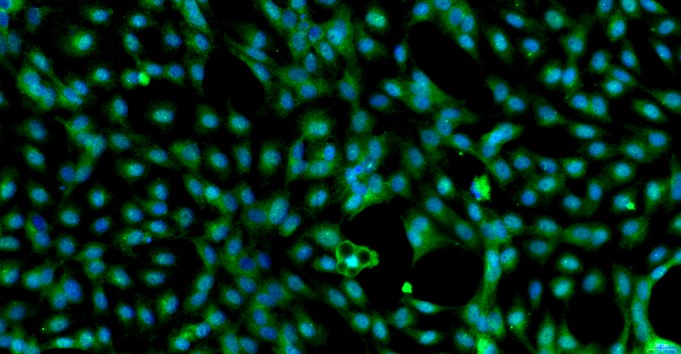 Primary Rat Adipose Microvascular Endothelial Cells (AMEC)