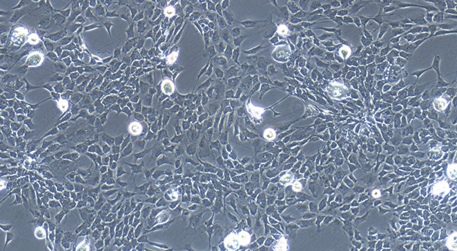 Primary Rat Adipose Microvascular Endothelial Cells (AMEC)