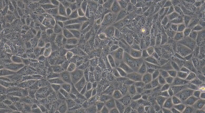 Primary Rat Hepatic Sinusoidal Endothelial Cells (HSEC)