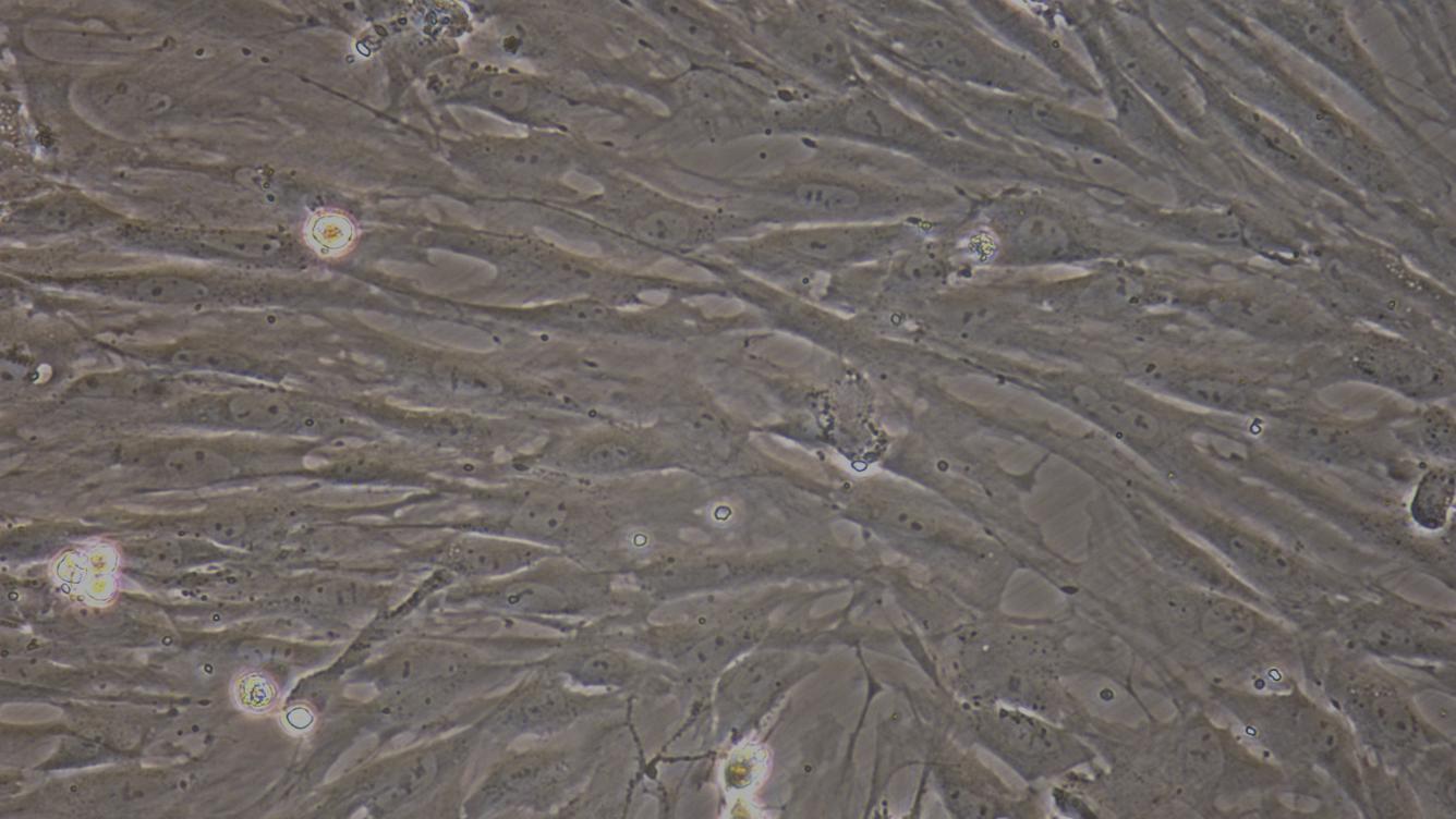 Primary Rat Prostate Fibroblasts (PF)