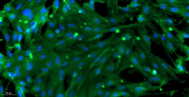 Primary Rat Prostate Fibroblasts (PF)