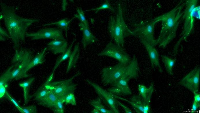 Primary Rat Pancreatic Stellate Cells (PaSC)