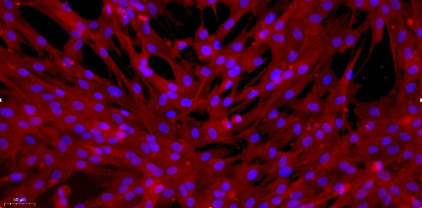 Primary Canine Aortic Smooth Muscle Cells (ASMC)