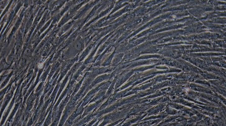 Primary Caprine Aortic Smooth Muscle Cells (ASMC)